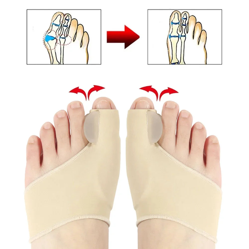Toe Separator Hallux Valgus Bunion Corrector Orthotics