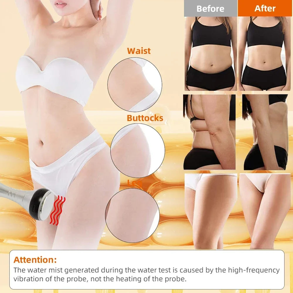 Missheart Cavitation Ultrasonic Body Slimming Machine Beauty Device