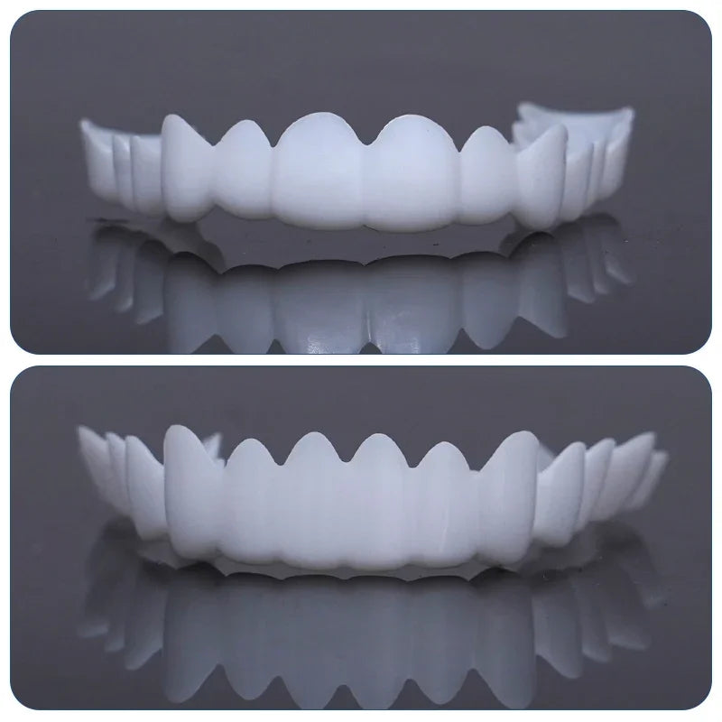 Dental Snap On Smile Veneers Temporary Resin Prosthesis