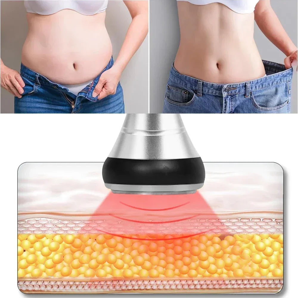 Beemyi 4-In-1 40K Cavitation Vacuum Body Slimming and RF