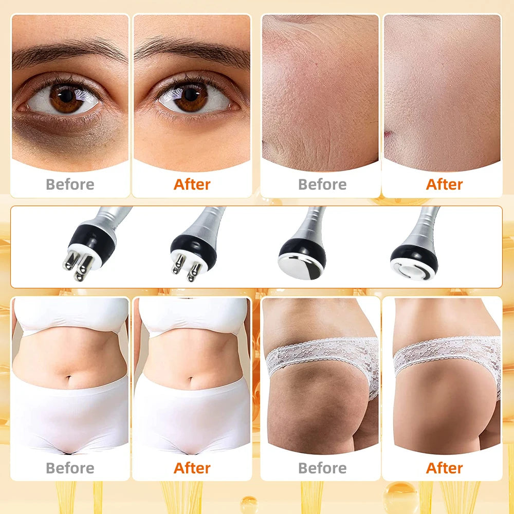 Moonic Beauty 4 In 1 Cavitation Machine Ultrasonic RF Shaping